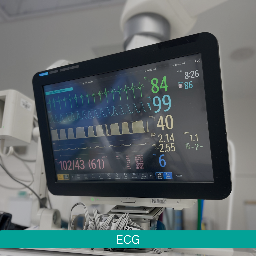 ecg