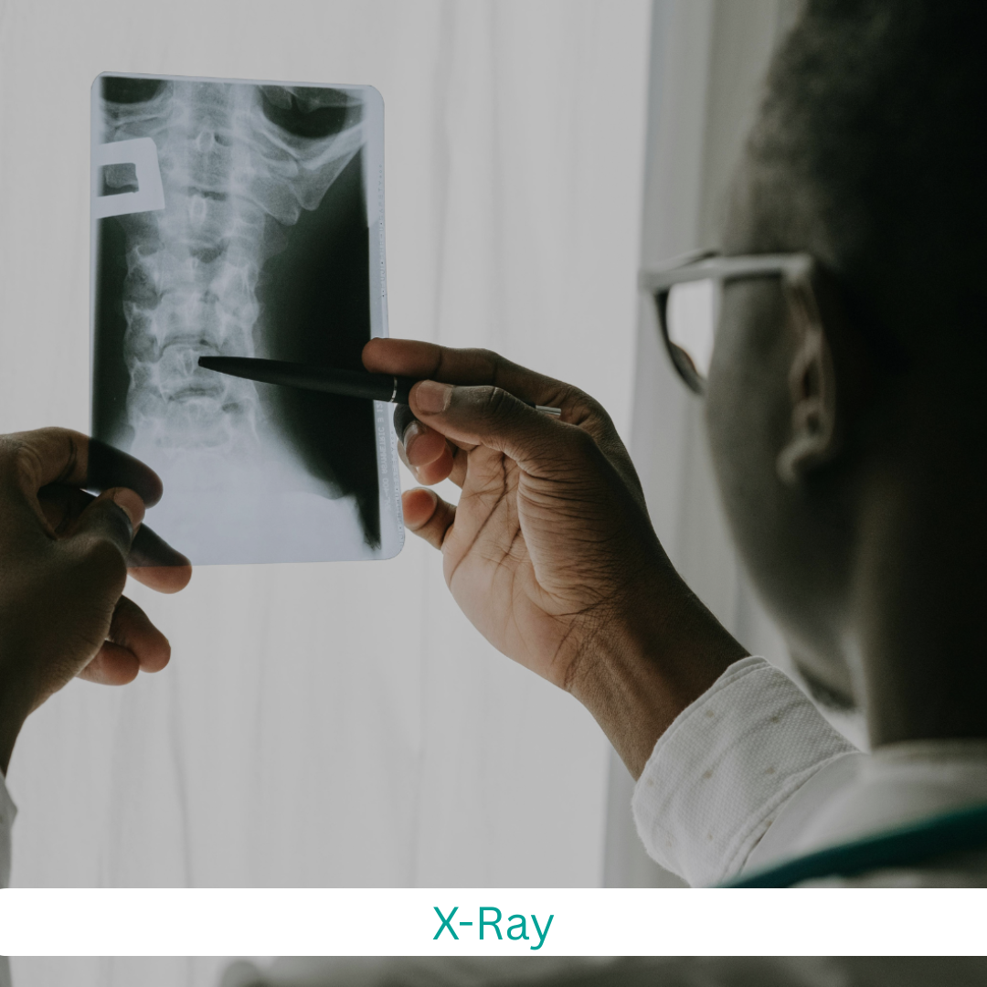 x ray