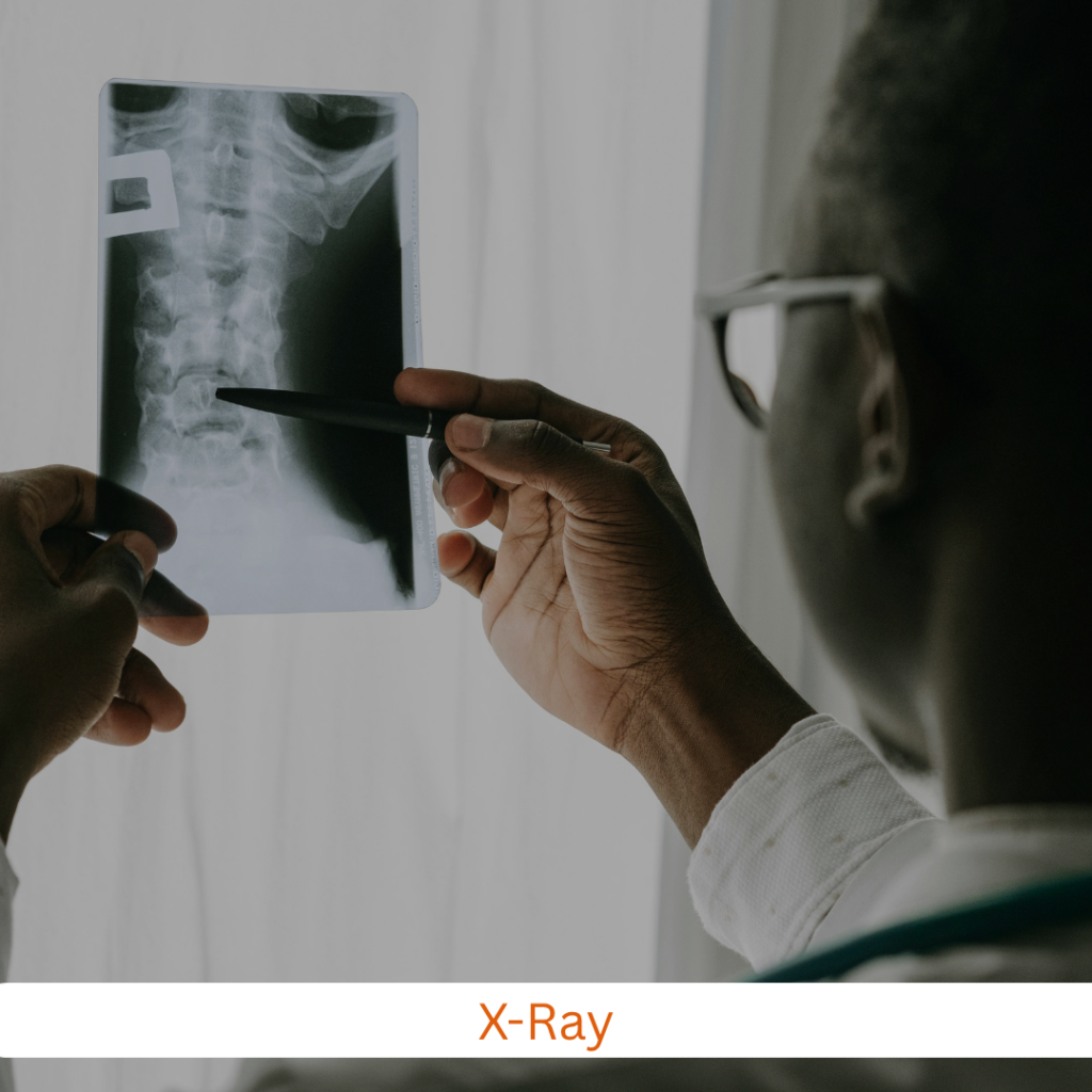 x ray (2)